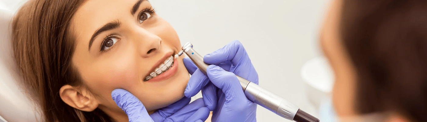 Braces (Metallic Or Tooth Colored Ceramic)