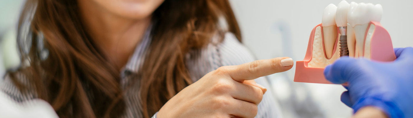 Single Tooth Implant