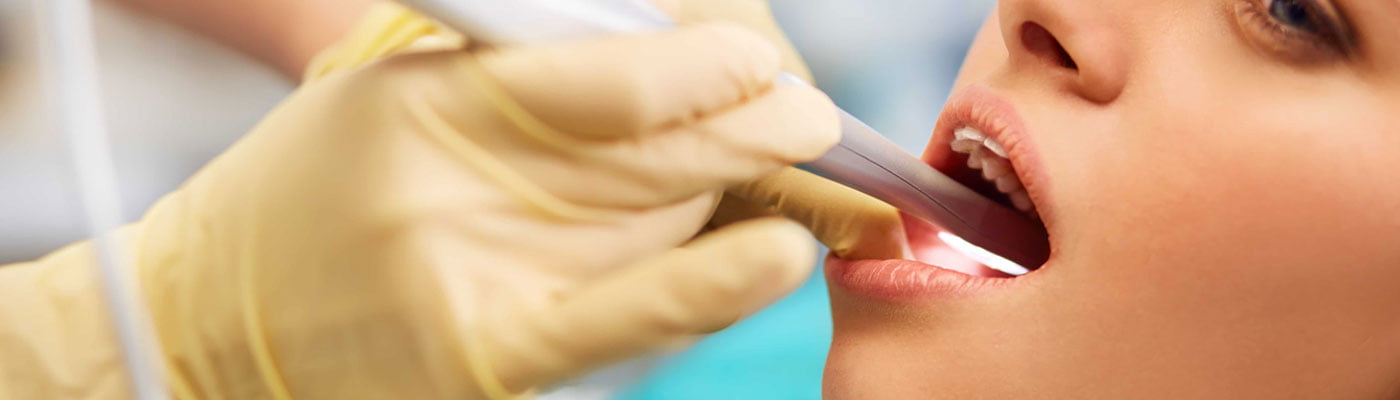 Root Canal Treatment